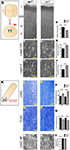 Frontiers | That’s A Wrap! Molecular Drivers Governing Neuronal Nogo ...