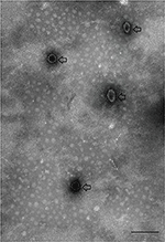 Frontiers | Proteomic Analysis Of Exosome-Like Vesicles Isolated From ...