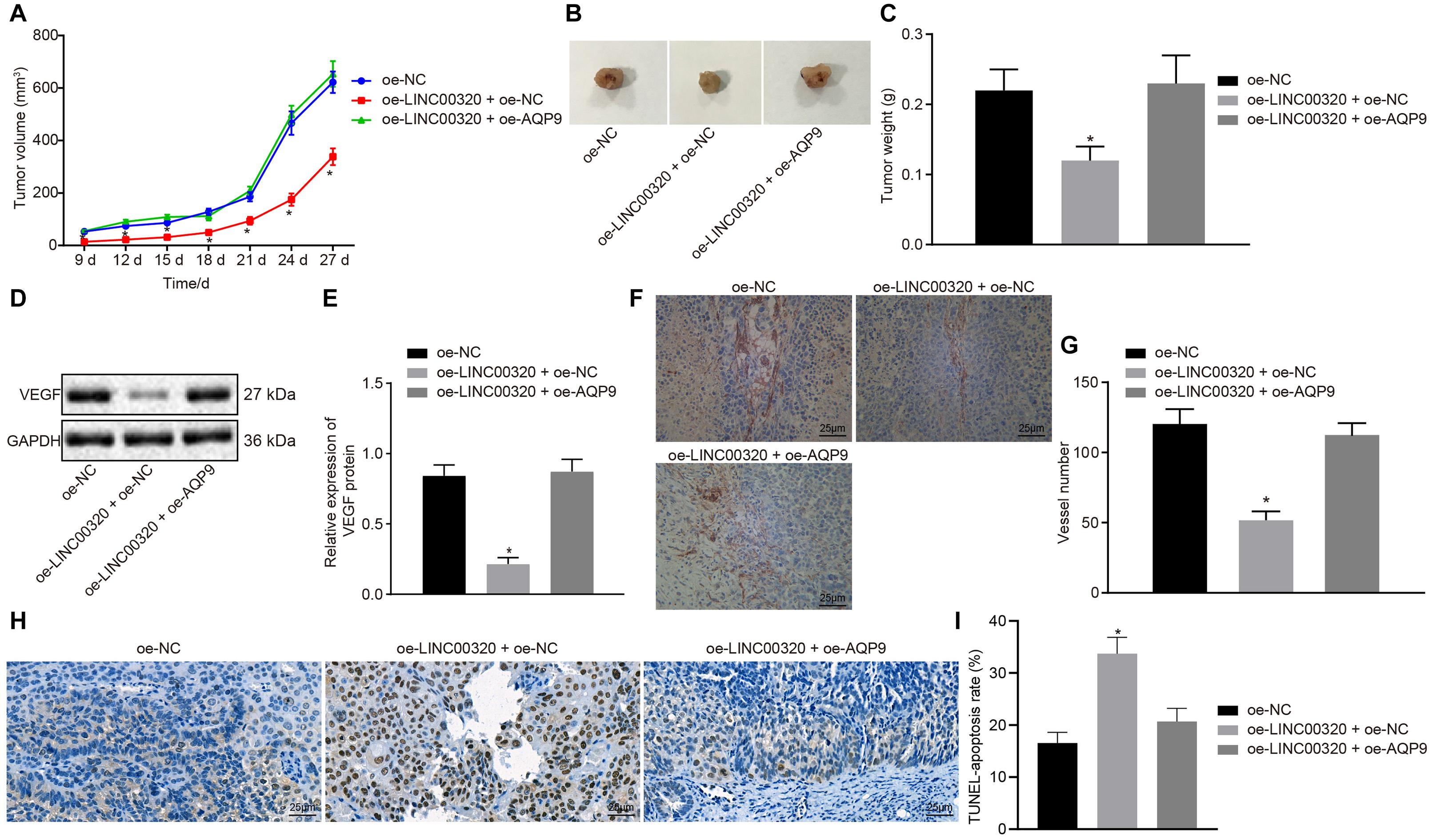 Frontiers | Long Non-coding RNA LINC00320 Inhibits Tumorigenicity of ...