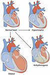 Frontiers | Distal Arthrogryposis and Lethal Congenital Contracture ...