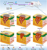 Frontiers | Functional Biomaterials for Treatment of Chronic Wound ...