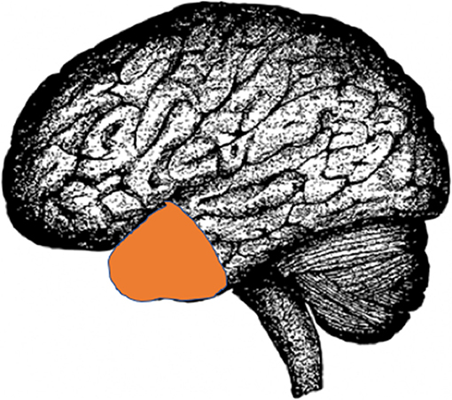 图2 -大脑的图片展示另一个叫做颞叶(橙色),治疗癫痫可以删除。