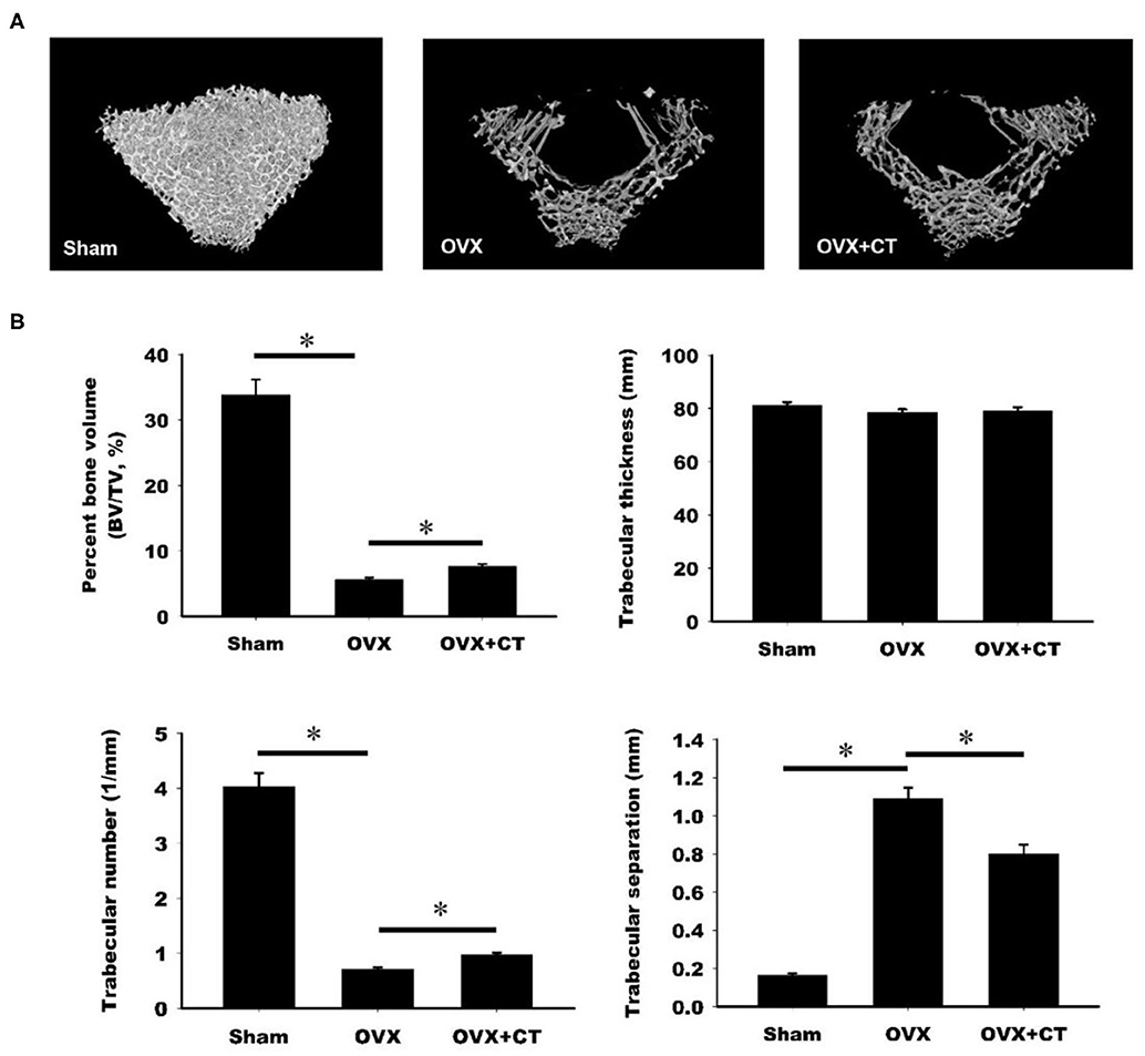 Smeren reservoir pop Frontiers | Calcitonin Induces Bone Formation by Increasing Expression of  Wnt10b in Osteoclasts in Ovariectomy-Induced Osteoporotic Rats