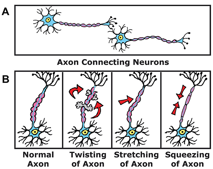 Figure 1 - (A) Your brain’s 60 billion nerve cells connect through long fibers called axons.