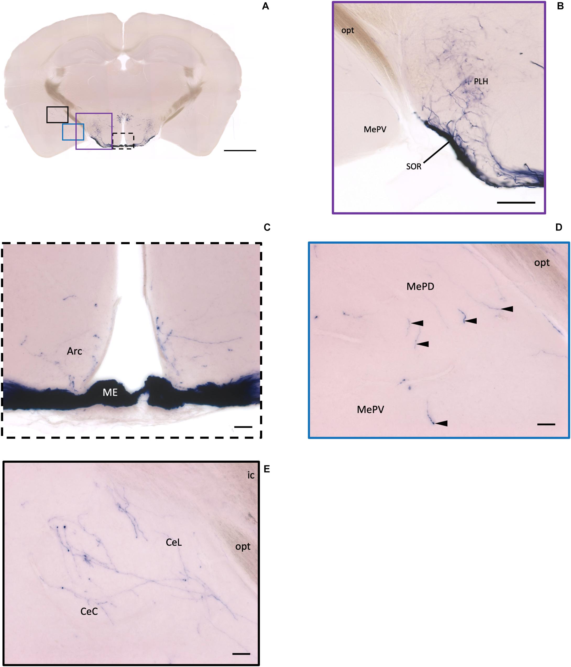 PVN-mPFC OXT projections are necessary for anti-anxiety in PMS rats a