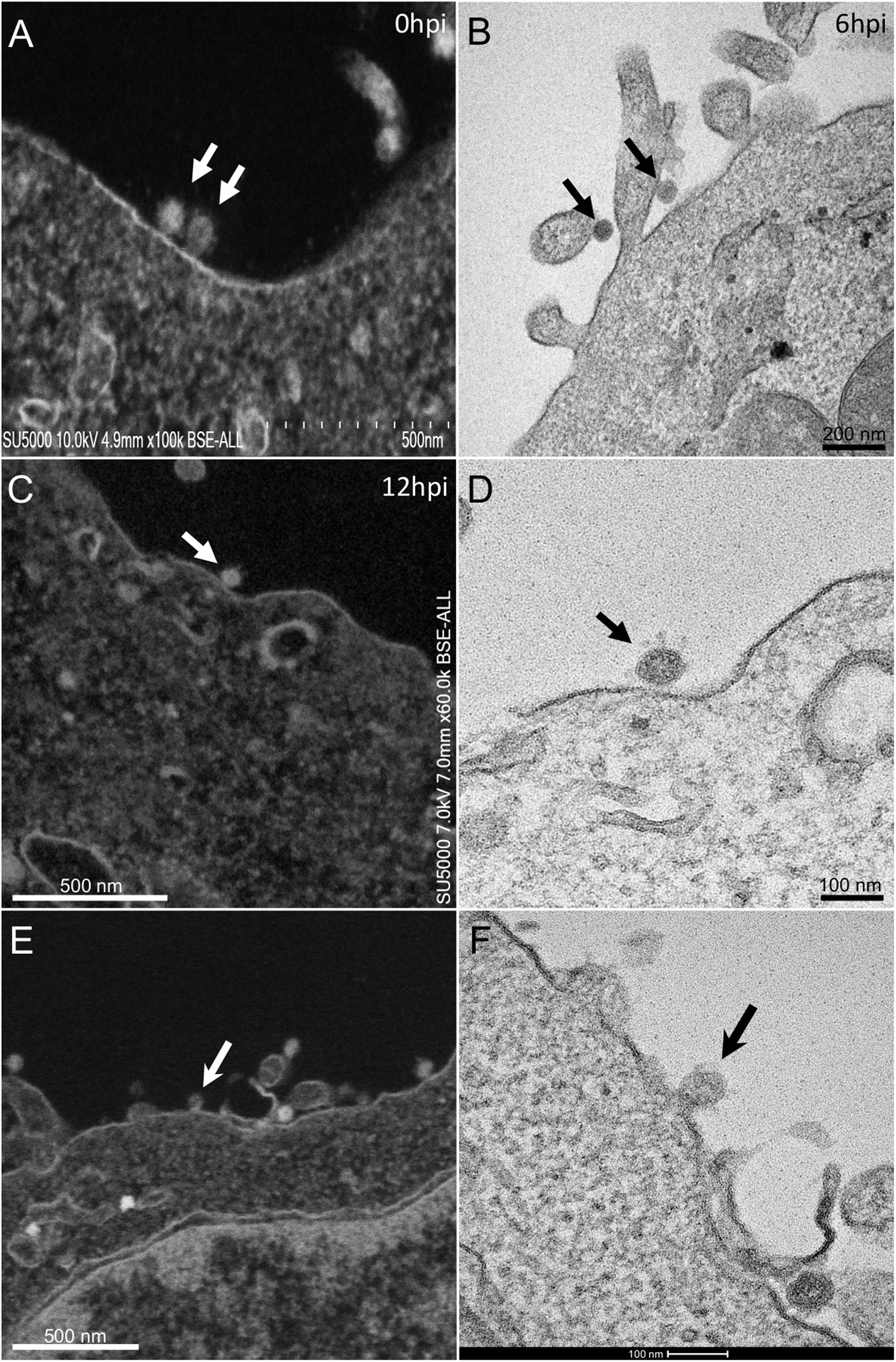 electron microscope images virus