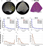 Frontiers | Quantitative Ultrashort Echo Time (UTE) Magnetic Resonance ...