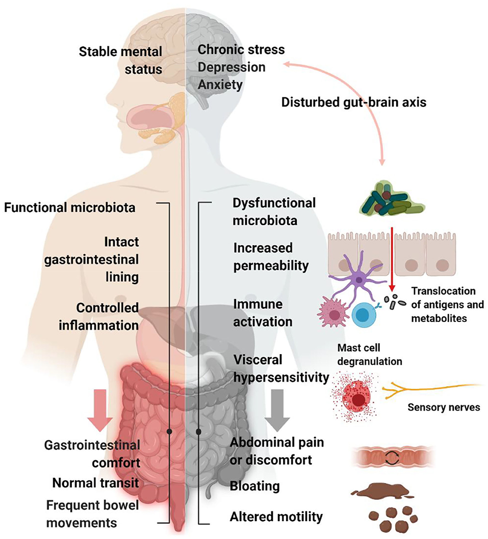 Frontiers  Increasing Evidence That Irritable Bowel Syndrome and  Functional Gastrointestinal Disorders Have a Microbial Pathogenesis