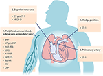 Frontiers | Current Understanding of Circulating Biomarkers in ...