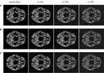 Frontiers | FFA-DMRI: A Network Based on Feature Fusion and Attention ...