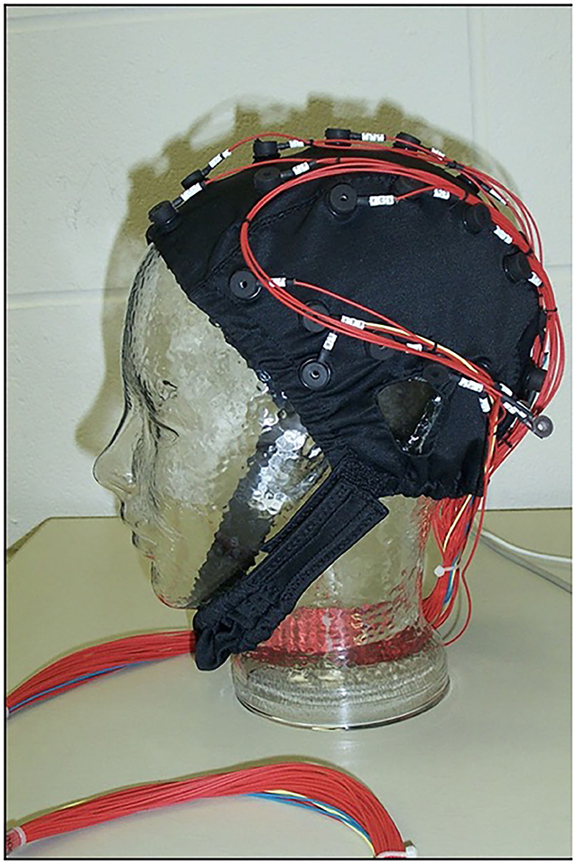 图1——一顶电极,用于测量大脑的电活动发生。