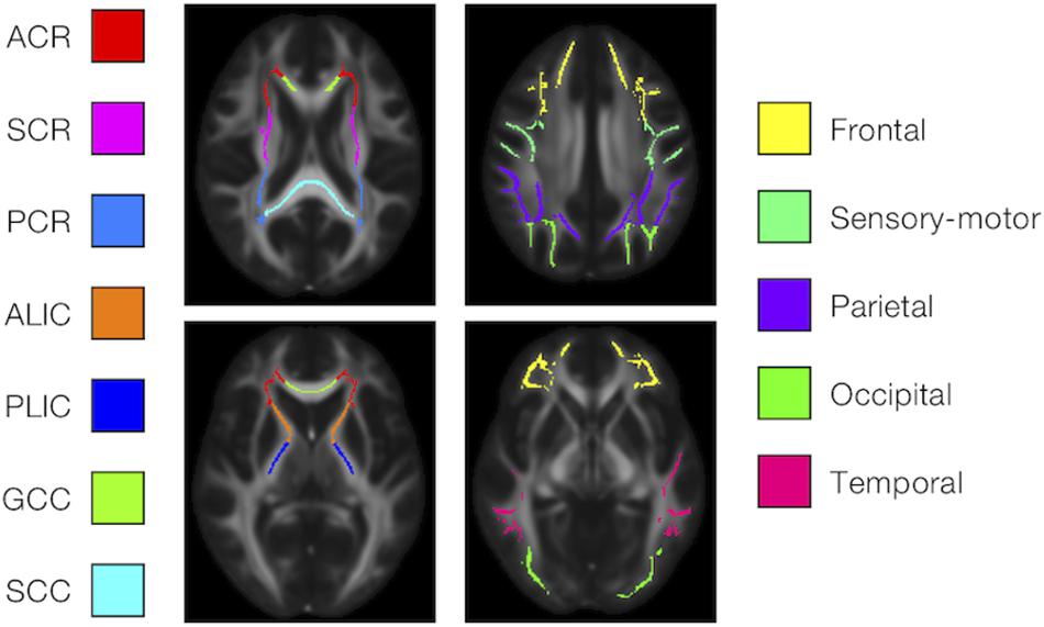 Frontiers | Brain White-Matter Degeneration Due to Aging and 