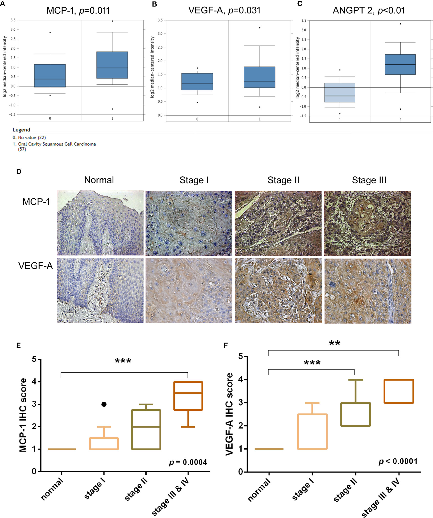 PDF) Abstract A74: Microparticles mediate cross-talk between tumoral and  endothelial cells and promote the constitution of an angiocrine  pro-metastatic niche through Arf6 up regulation