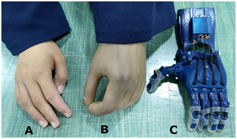 Frontiers  Suitability of the Openly Accessible 3D Printed