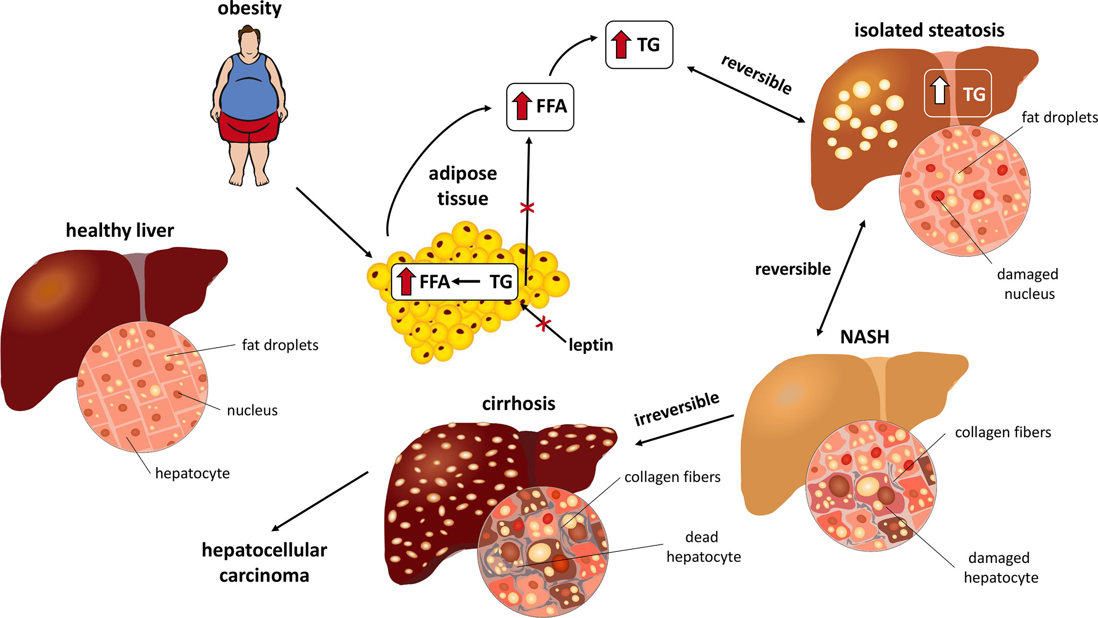 Frontiers Pathophysiology Of Nafld And Nash In Experimental Models The Role Of Food Intake Regulating Peptides Endocrinology