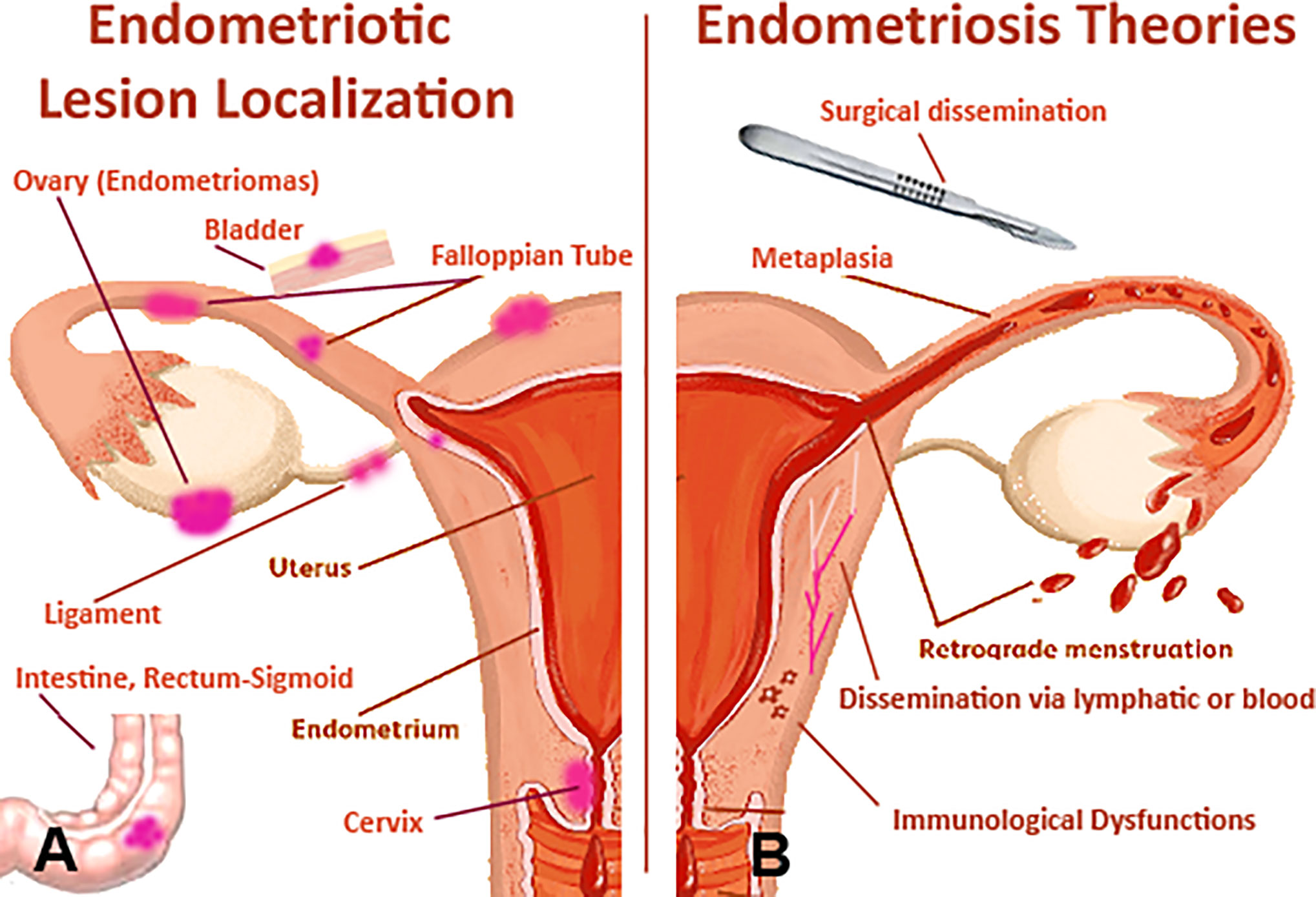 Endometriosis Nails