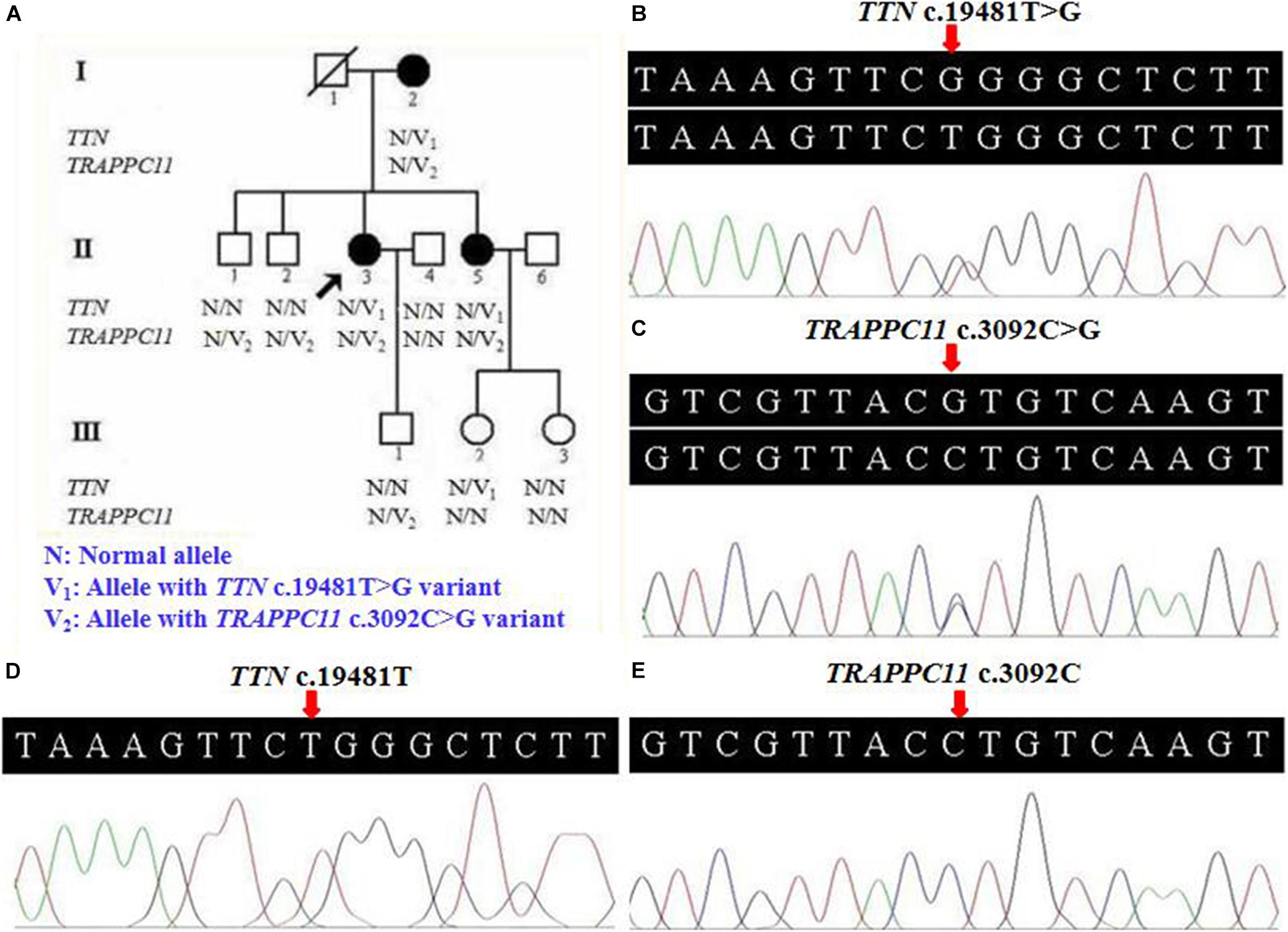 Frontiers Digenic Variants In The Ttn And Trappc11 Genes Co Segregating With A Limb Girdle Muscular Dystrophy In A Han Chinese Family Neuroscience