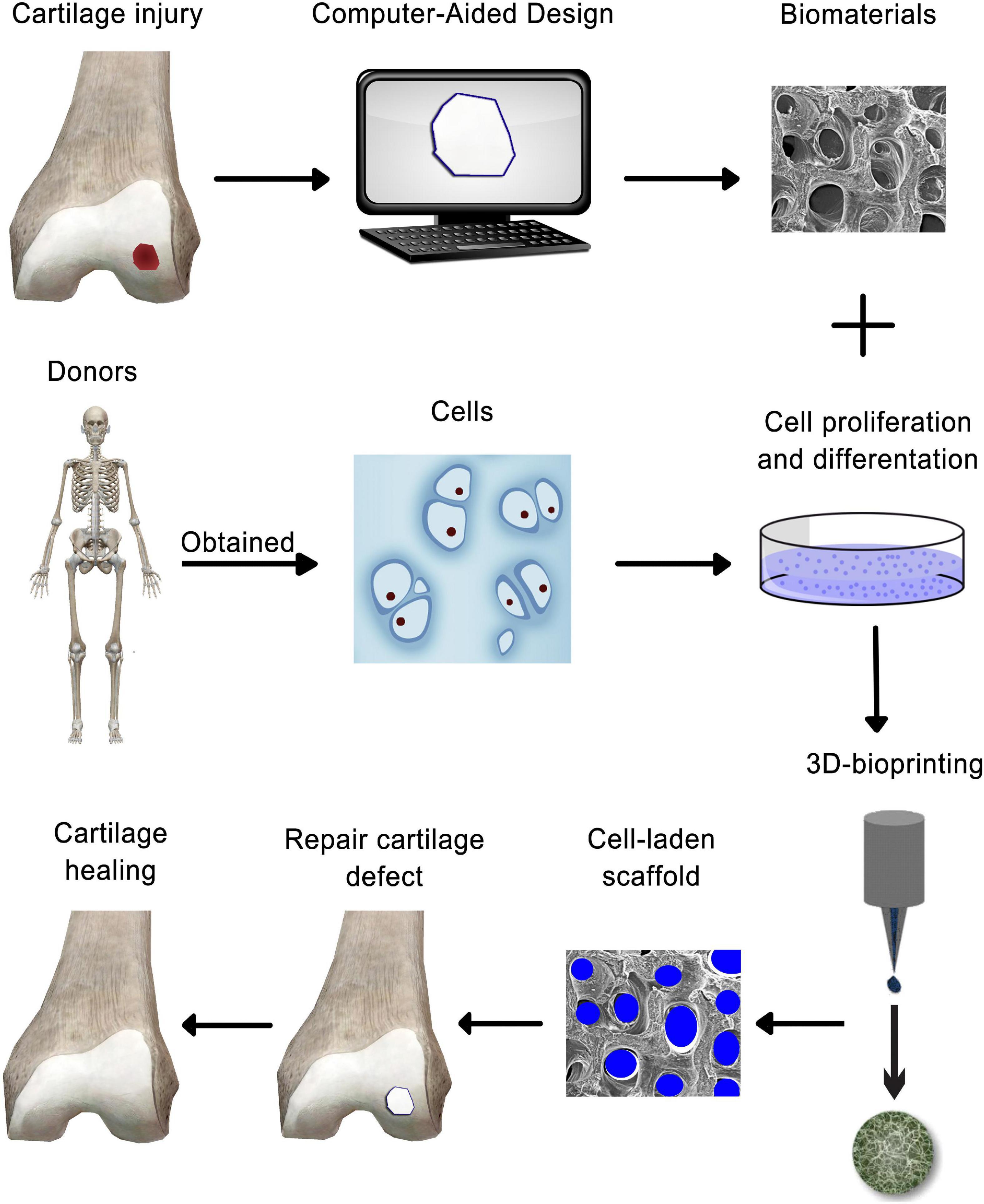 Frontiers  Applications of Biocompatible Scaffold Materials in Stem  Cell-Based Cartilage Tissue Engineering