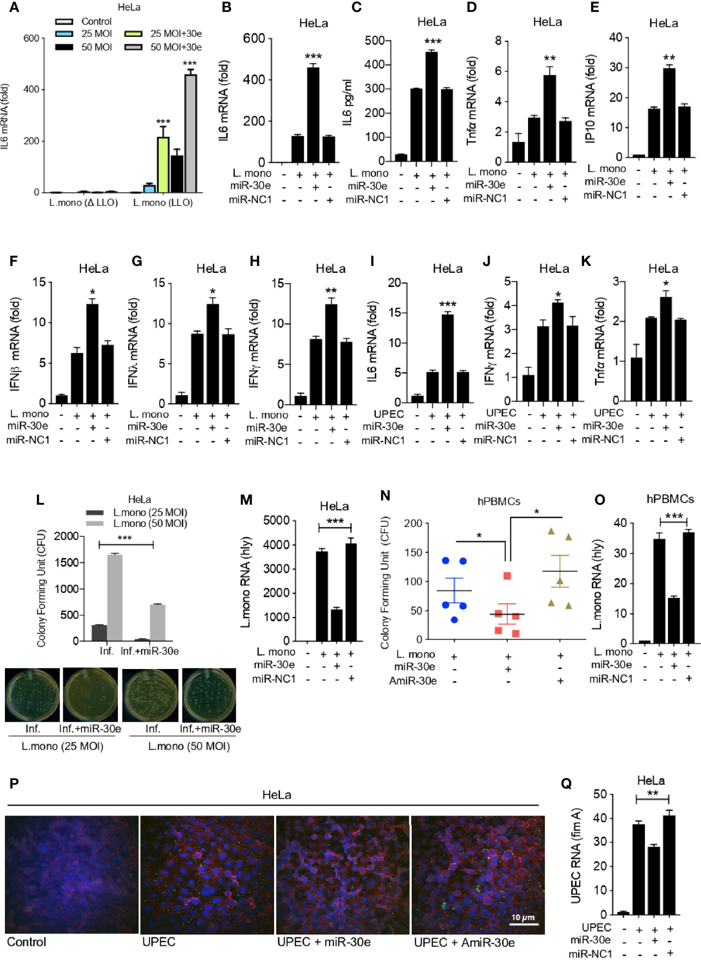 Frontiers  MicroRNA-30e-5p Regulates SOCS1 and SOCS3 During