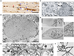 Forskolin Induced Varicosity Formation And Axonal Elongation In The