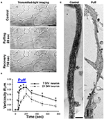 Forskolin Induced Varicosity Formation And Axonal Elongation In The