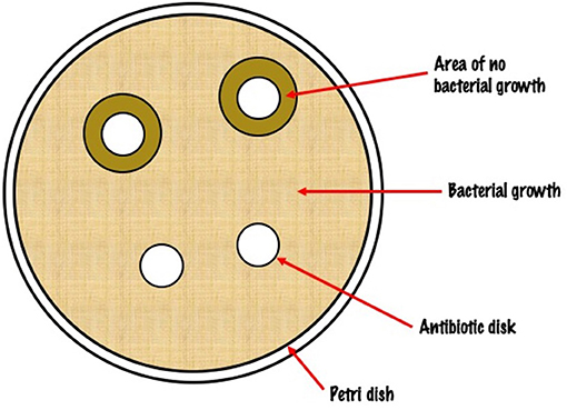 图1——一个培养皿中覆盖着细菌,显示区域没有细菌生长在含有抗生素的光盘。