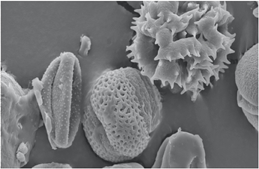 图3 -从抗菌蜂蜜样品中提取的花粉粒，在电子显微镜下观察。