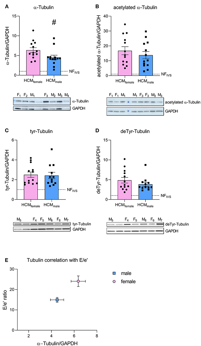 Frontiers Sex Related Differences In Protein Expression In Sarcomere Mutation Positive 