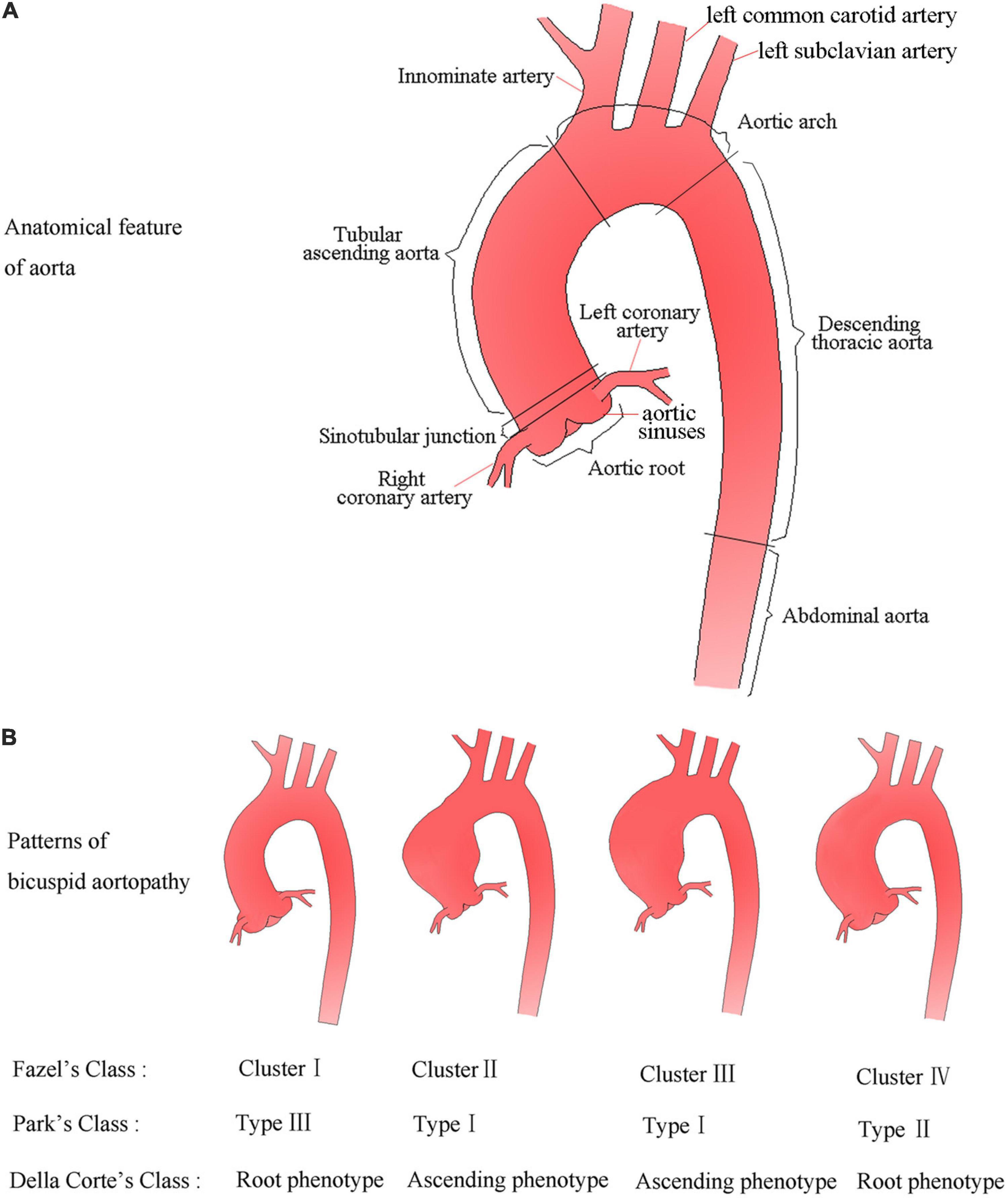 Explanation of terms. The contrast medium aortic arrival time is the