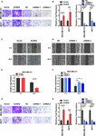 Frontiers | Potassium Channel Protein KCNK6 Promotes Breast Cancer Cell ...