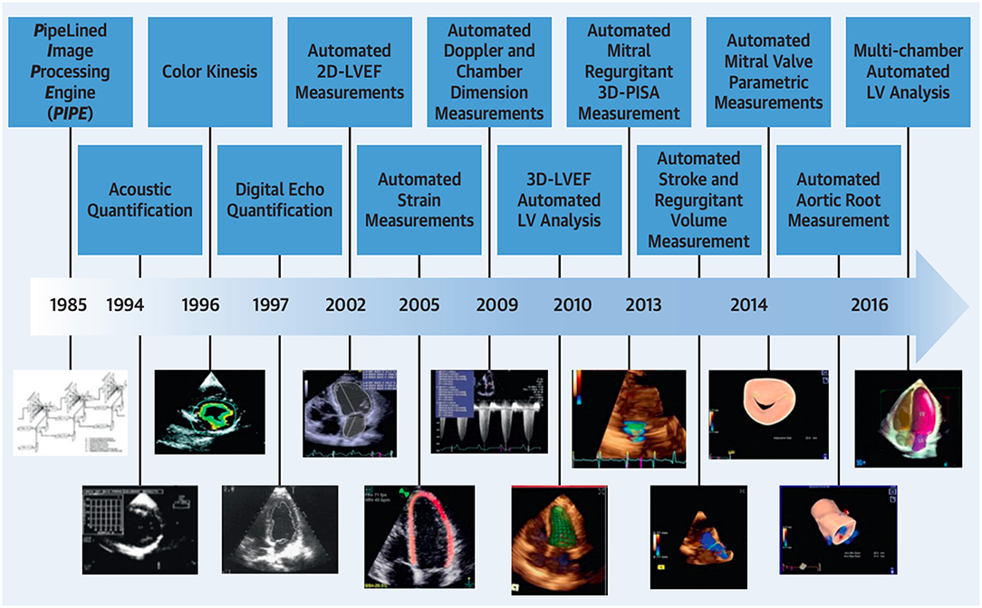 Frontiers The Role Of Artificial Intelligence In Cardiovascular 