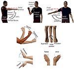 Frontiers | Tremor-Suppression Orthoses for the Upper Limb: Current ...