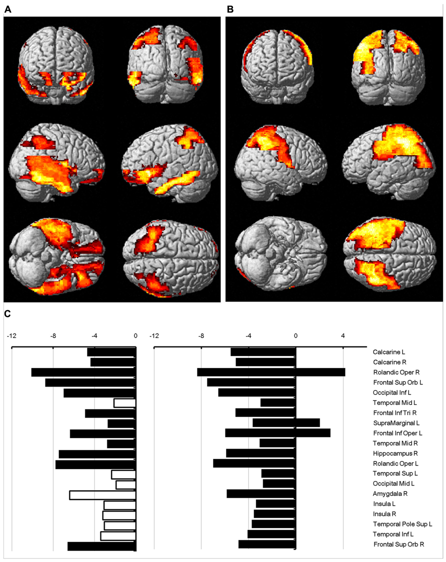 Frontiers Sex Dimorphism Of Cortical Water Diffusion In Normal Aging Free Download Nude Photo 9014