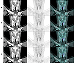 Frontiers | Assessment Of Image Quality And Lesion Detectability With ...