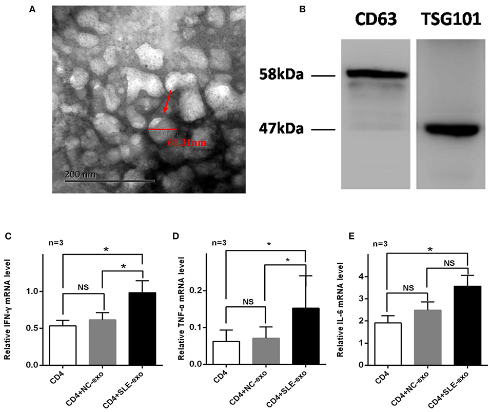 Frontiers  Downregulated Serum Exosomal miR-451a Expression Correlates  With Renal Damage and Its Intercellular Communication Role in Systemic  Lupus Erythematosus