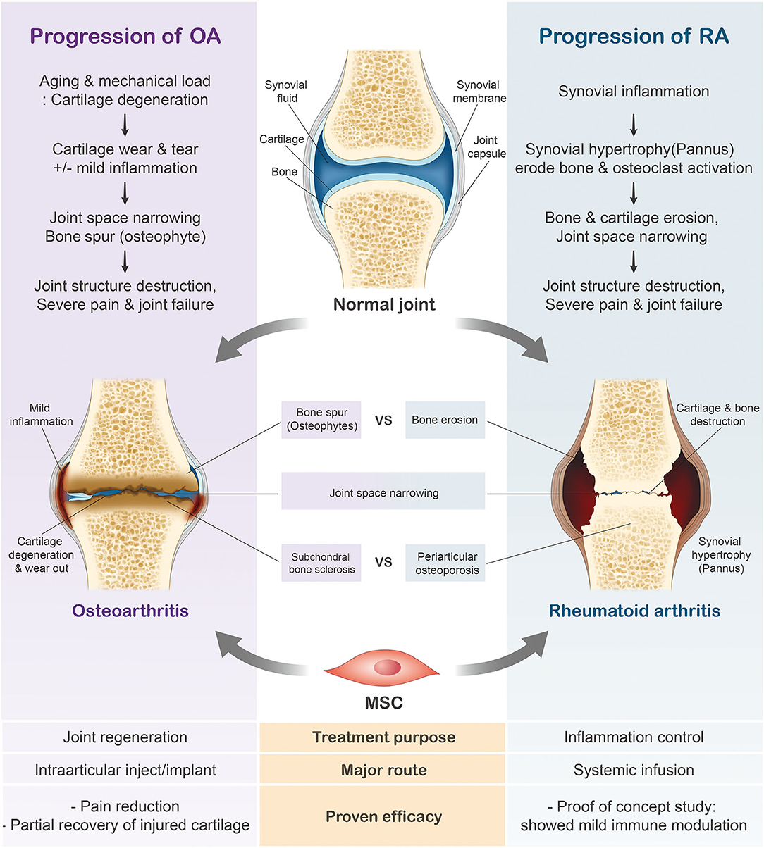 Earth clinic arthritis