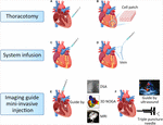 Frontiers | The Current Dilemma and Breakthrough of Stem Cell Therapy ...