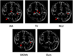 Frontiers | Fast and High-Resolution Neonatal Brain MRI Through Super ...