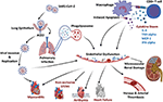 Frontiers | Microvascular Angiopathic Consequences of COVID-19 ...