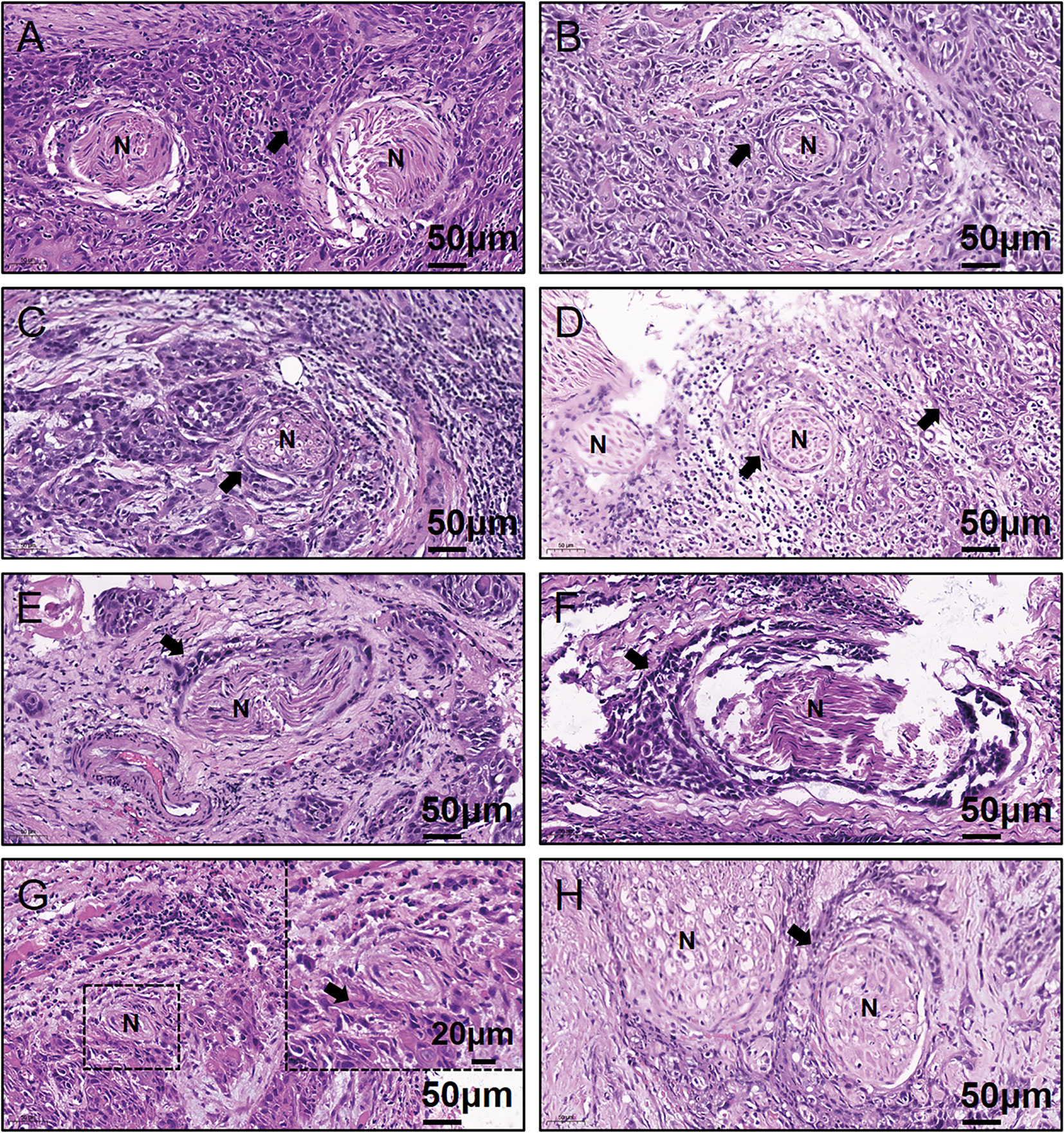 Frontiers Asparagine Synthetase Mediated L Asparagine Metabolism Disorder Promotes The 0820