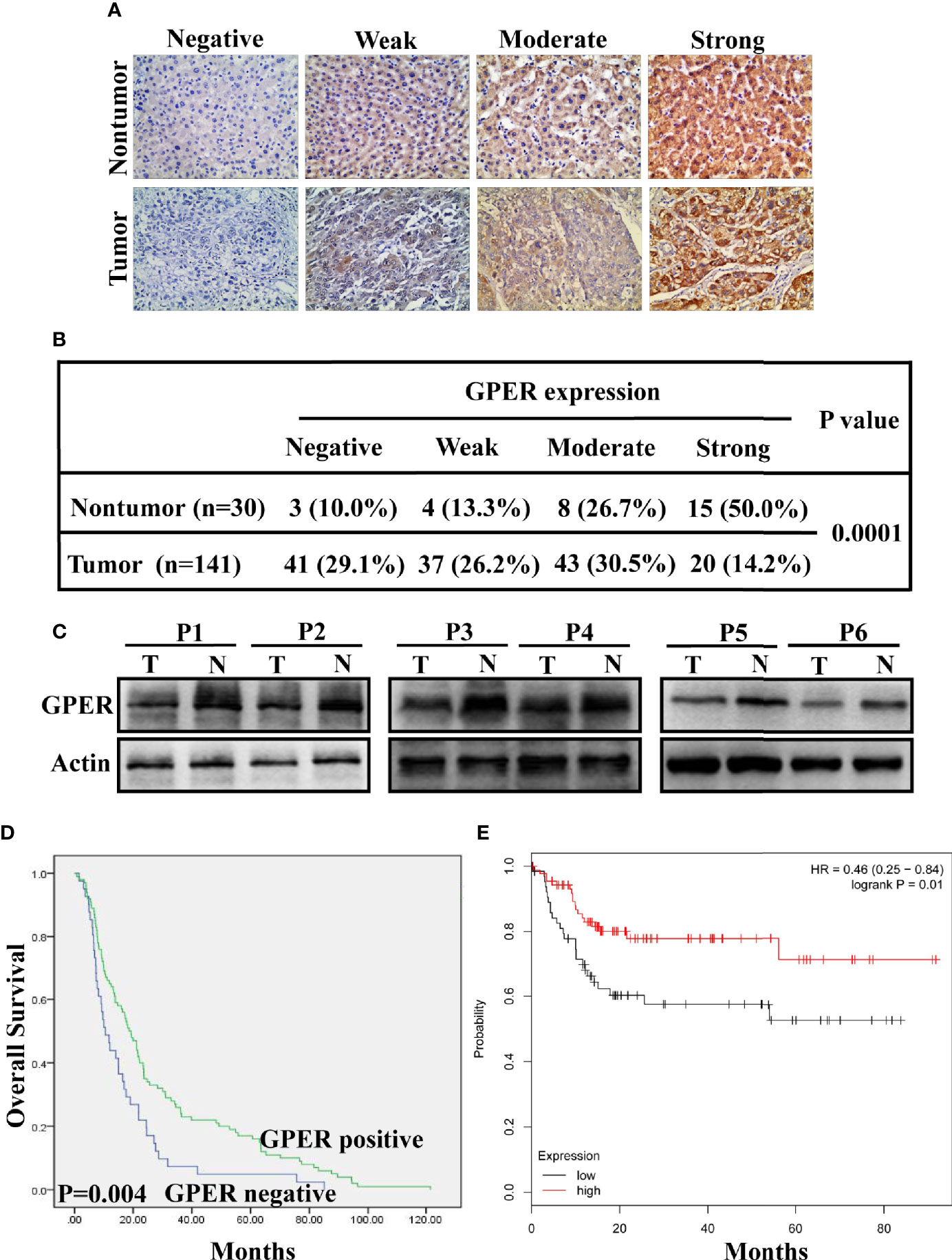Frontiers Gper Induced Erk Signaling Decreases Cell Viability Of Hepatocellular Carcinoma Oncology