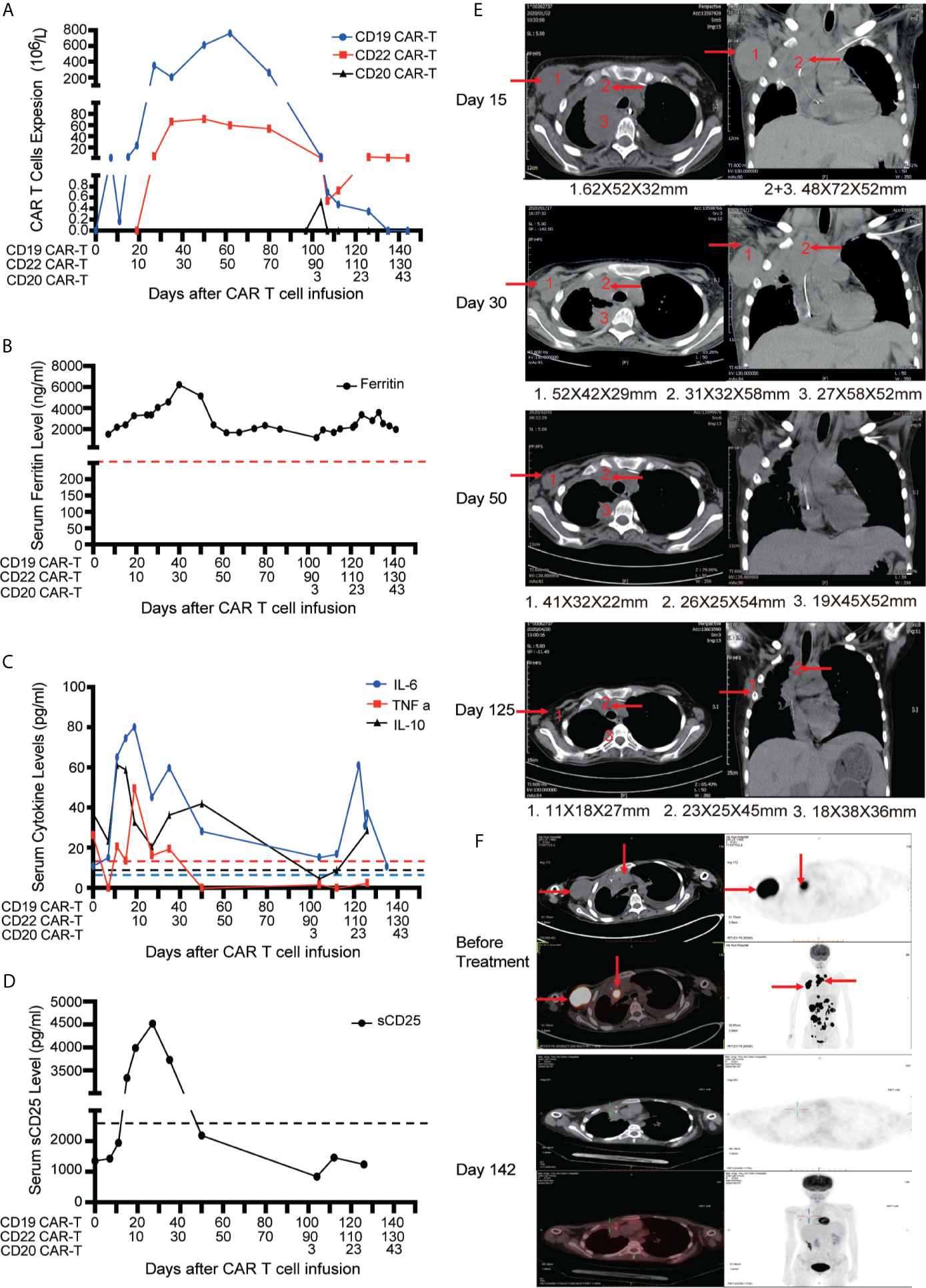 Frontiers | Short-Interval Sequential CAR-T Cell Infusion May Enhance ...