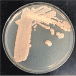 Frontiers | Comparison of Cryptococcus gattii/neoformans Species ...