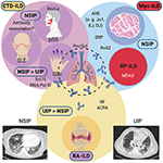 Frontiers | Editorial: Interstitial Lung Disease in the Context of ...