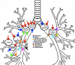 Frontiers | Benign Endobronchial Tumors: A Clinicopathologic Review ...