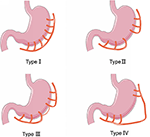 Frontiers | Simultaneous Vascular Reconstruction and Cervical ...