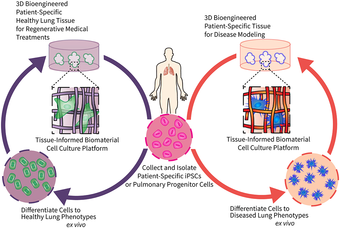 Frontiers  Engineering Tissue-Informed Biomaterials to Advance Pulmonary  Regenerative Medicine