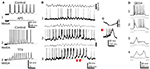 Frontiers | The Theta Rhythm Of The Hippocampus: From Neuronal And ...