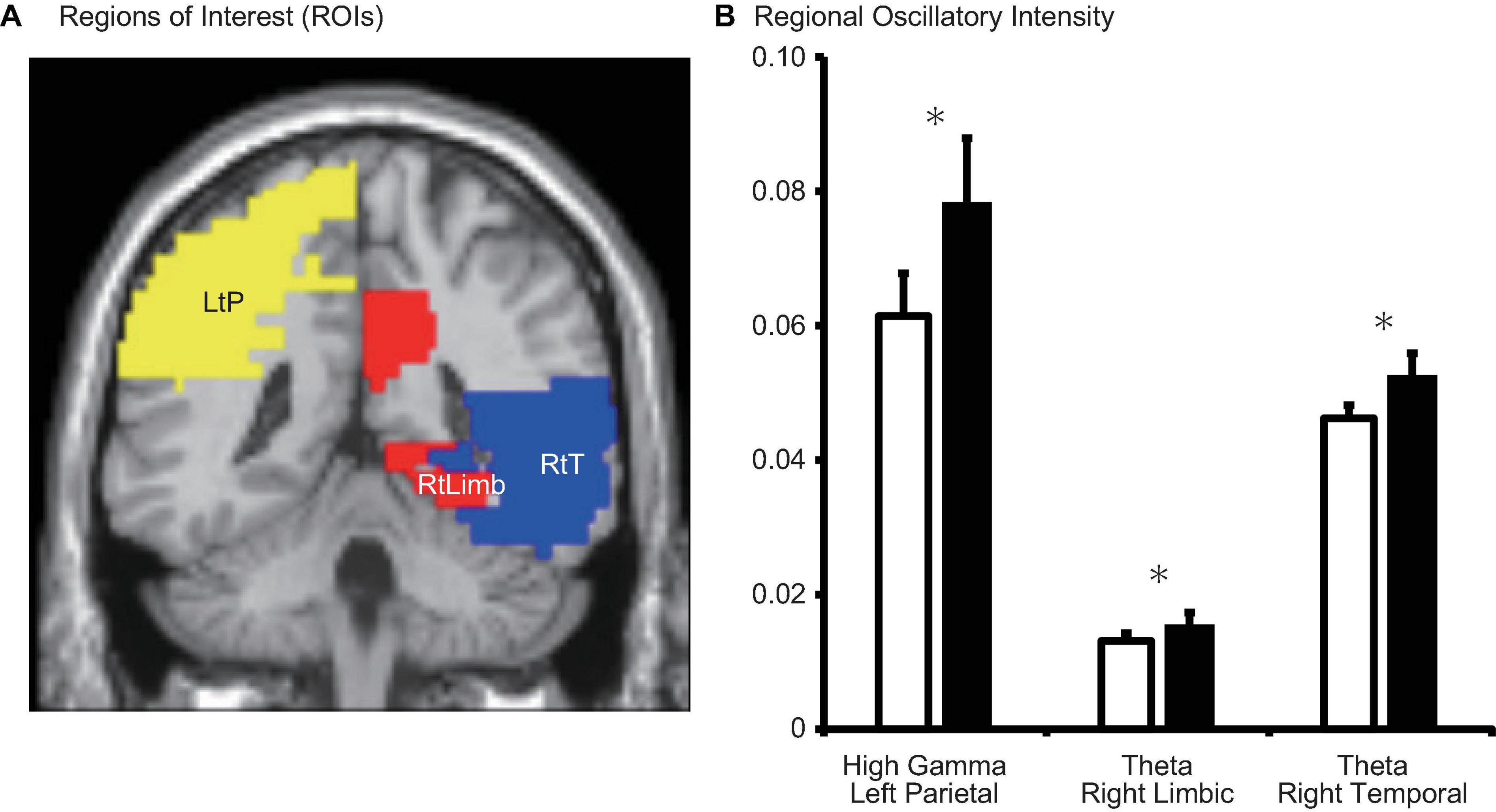 Frontiers  The Menstrual Cycle Modulates Whole-Brain Turbulent Dynamics