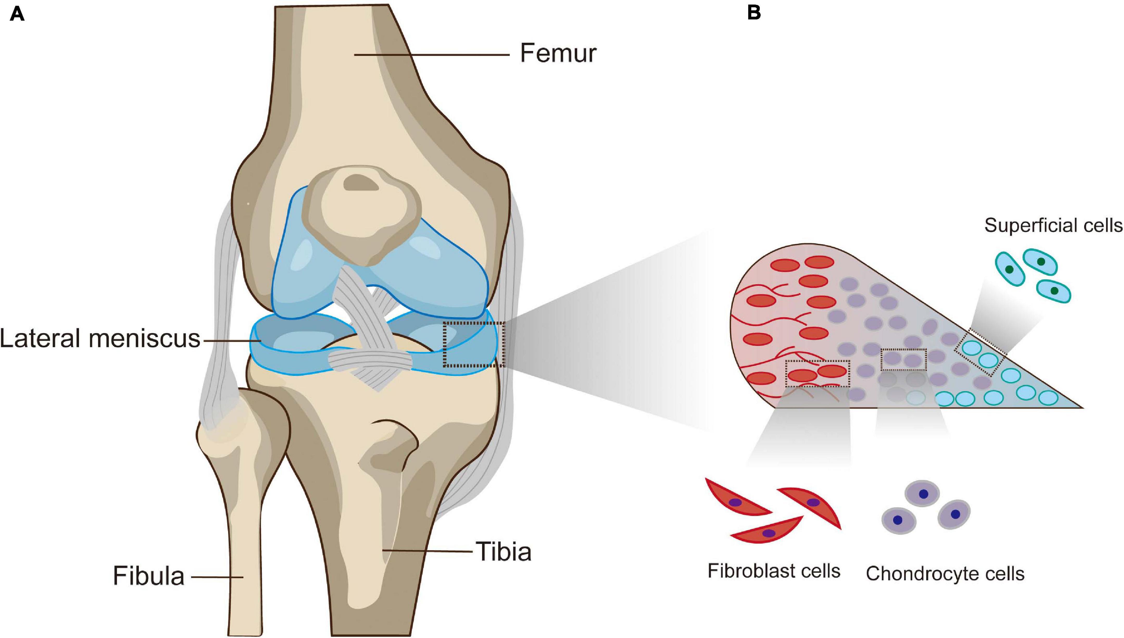 Will a Knee Brace Help a Torn Meniscus? – Dunn Medical